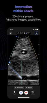Butterfly-iQ Ultrasound Imagining Screenshot