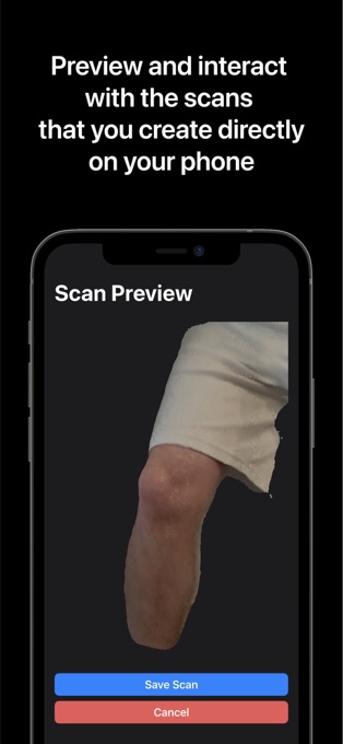 Icarus Medical Preview and Interact with the scans that you create on your phone screen