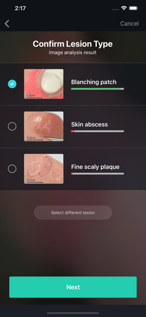 VisualDx Confirm Lesion Type Screen